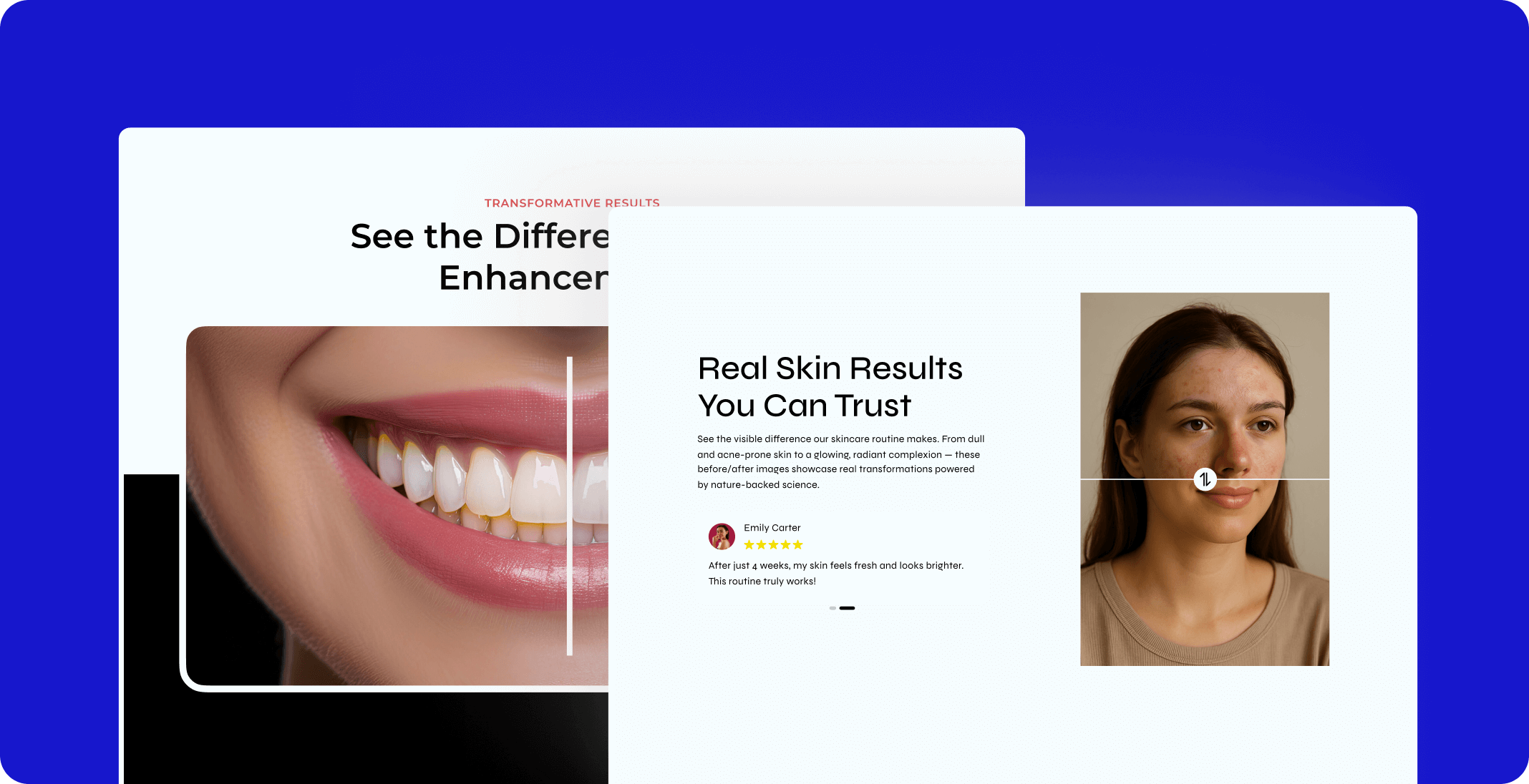Nexter for Marketers 27 before after show off 1