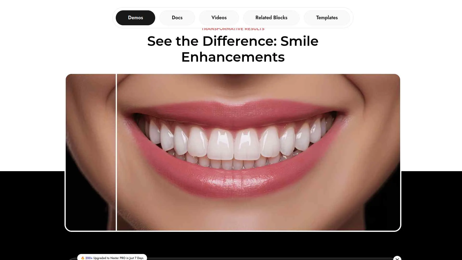 5 Best Before After Plugins for WordPress Compared 6 Before After by Nexter Demo 1